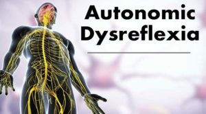 x-ray diagram of circulatory system with phrase "autonomic dysreflexia"