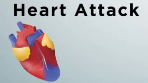 diagram of heart "Heart Attack"